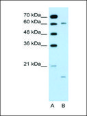 Anti-CYP4A22 antibody produced in rabbit affinity isolated antibody
