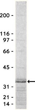 Rho检测试剂（Rhotekin RBD，琼脂糖），650 &#181;g Specifically binds to &amp; precipitates GTP-Rho, but not GDP-Rho from cell lysates. For use in Affinity Binding Assays.