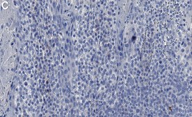 Anti-MRP-8/14 Antibody, clone AHN-17 ZooMAb® Mouse Monoclonal recombinant, expressed in HEK 293 cells