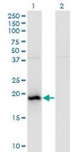 Monoclonal Anti-BAALC, (C-terminal) antibody produced in mouse clone 2A2, purified immunoglobulin, buffered aqueous solution