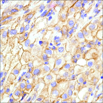 Anti-N-Cadherin, Rabbit monoclonal clone SP90, recombinant, expressed in proprietary host, affinity isolated antibody