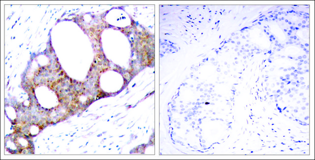 Anti-phospho-GSK3A (pSer21) antibody produced in rabbit affinity isolated antibody