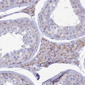 Anti-TMEM206 antibody produced in rabbit Prestige Antibodies® Powered by Atlas Antibodies, affinity isolated antibody, buffered aqueous glycerol solution