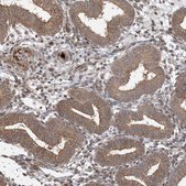 Anti-ABCF3 antibody produced in rabbit Prestige Antibodies® Powered by Atlas Antibodies, affinity isolated antibody, buffered aqueous glycerol solution