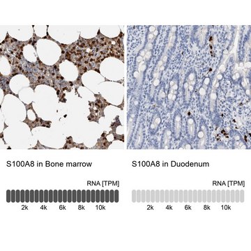 Anti-S100A8 antibody produced in rabbit Prestige Antibodies&#174; Powered by Atlas Antibodies, affinity isolated antibody, buffered aqueous glycerol solution