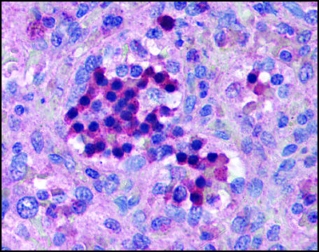 Anti-IRF7 (AB1) antibody produced in rabbit affinity isolated antibody, buffered aqueous solution