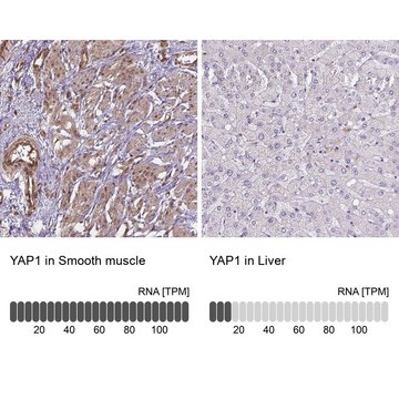 Anti-YAP1 Prestige Antibodies&#174; Powered by Atlas Antibodies, affinity isolated antibody