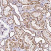 Anti-SERP1 antibody produced in rabbit Prestige Antibodies® Powered by Atlas Antibodies, affinity isolated antibody, buffered aqueous glycerol solution
