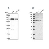 Anti-DARS2 antibody produced in rabbit Prestige Antibodies® Powered by Atlas Antibodies, affinity isolated antibody, buffered aqueous glycerol solution, Ab2