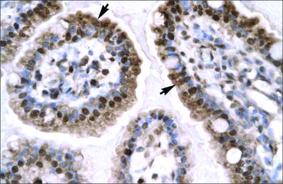 Anti-EGR1 antibody produced in rabbit affinity isolated antibody