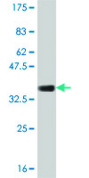 Monoclonal Anti-COL23A1 antibody produced in mouse clone 2E10, purified immunoglobulin, buffered aqueous solution