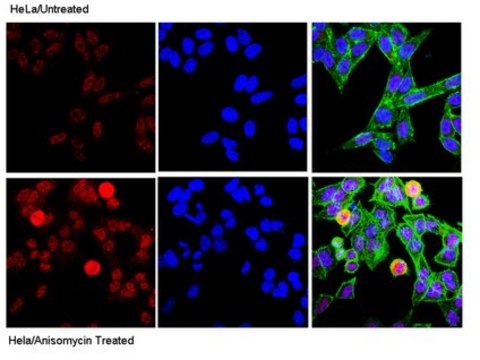 Anti-phospho-c-Jun (Ser73) Antibody Upstate&#174;, from rabbit