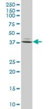 Anti-FBP1 antibody produced in mouse purified immunoglobulin, buffered aqueous solution