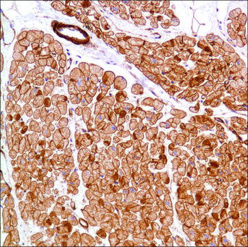 Anti-Vinculin antibody, Rabbit monoclonal recombinant, expressed in proprietary host, clone SP117, affinity isolated antibody