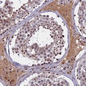 Anti-CDC7 antibody produced in rabbit Prestige Antibodies® Powered by Atlas Antibodies, affinity isolated antibody, buffered aqueous glycerol solution