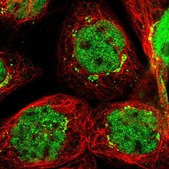 Anti-SLITRK5 antibody produced in rabbit Prestige Antibodies® Powered by Atlas Antibodies, affinity isolated antibody, buffered aqueous glycerol solution