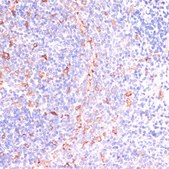 Anti-IKBKE antibody produced in rabbit