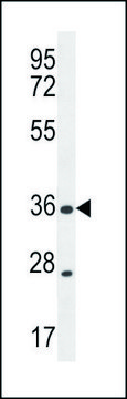 ANTI-XCR1 (C-TERM) antibody produced in rabbit IgG fraction of antiserum, buffered aqueous solution