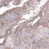 Anti-GPC3 antibody produced in mouse Prestige Antibodies® Powered by Atlas Antibodies, clone CL12711, purified by using Protein A, buffered aqueous glycerol solution