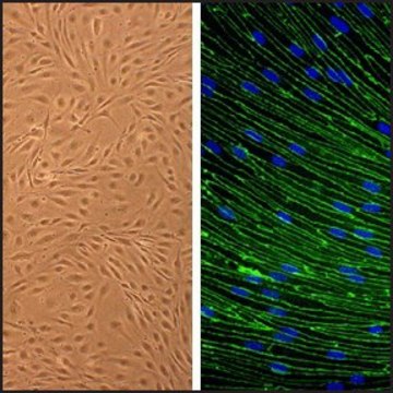 Rat Brain Microvascular Endothelial Cells: RBMVEC, adult