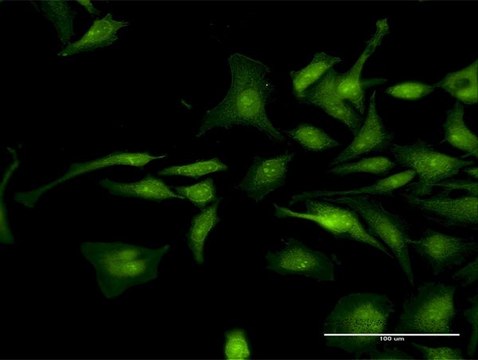 Anti-CTNND1 antibody produced in rabbit purified immunoglobulin, buffered aqueous solution