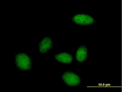 Anti-ZHX3 antibody produced in mouse purified immunoglobulin, buffered aqueous solution