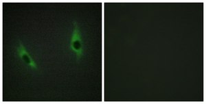 Anti-LAMB3 antibody produced in rabbit affinity isolated antibody