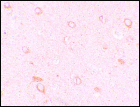 Anti-CIITA antibody produced in rabbit affinity isolated antibody