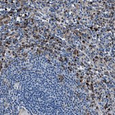 Anti-FGL2 antibody produced in rabbit Prestige Antibodies® Powered by Atlas Antibodies, affinity isolated antibody, buffered aqueous glycerol solution, Ab1