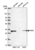 Anti-PNPO antibody produced in rabbit Prestige Antibodies® Powered by Atlas Antibodies, affinity isolated antibody, buffered aqueous glycerol solution