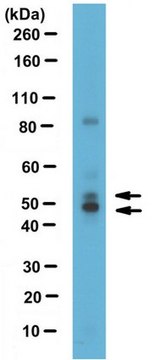 Anti-Nuclear factor 1/C Antibody serum, from rabbit