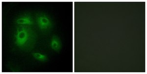 Anti-DLEC1 antibody produced in rabbit affinity isolated antibody