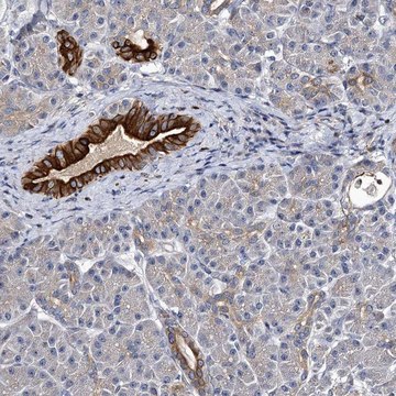 Anti-SLC11A2 antibody produced in rabbit Prestige Antibodies&#174; Powered by Atlas Antibodies, affinity isolated antibody, buffered aqueous glycerol solution