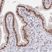 Anti-PLK3 antibody produced in rabbit Prestige Antibodies® Powered by Atlas Antibodies, affinity isolated antibody, buffered aqueous glycerol solution
