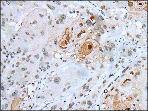 Anti-HOXC4 affinity isolated antibody