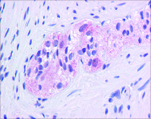 Anti-EGR1 antibody produced in rabbit affinity isolated antibody