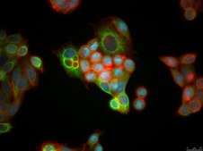 HCC95 Human Lung Squamous Carcinoma Cell Line