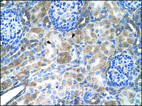 Anti-LAB antibody produced in rabbit affinity isolated antibody