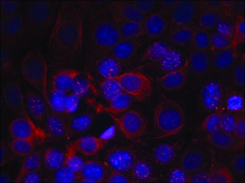 Anti-phospho-ERBB2 (pTyr1221/pTyr1222) antibody produced in rabbit affinity isolated antibody