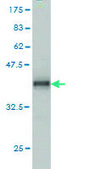 Monoclonal Anti-ADAM12 antibody produced in mouse clone 1G3, purified immunoglobulin, buffered aqueous solution