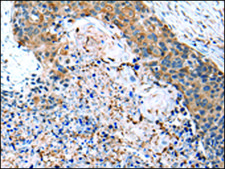 Anti-CD14 affinity isolated antibody