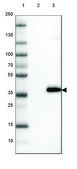 Anti-CTGF antibody produced in rabbit Prestige Antibodies® Powered by Atlas Antibodies, affinity isolated antibody, buffered aqueous glycerol solution, ab1