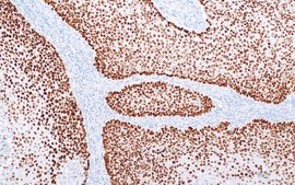 p40 (ZR8) Rabbit Monoclonal Antibody