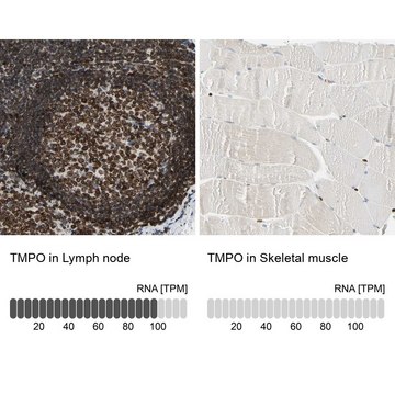 Anti-TMPO antibody produced in rabbit Prestige Antibodies&#174; Powered by Atlas Antibodies, affinity isolated antibody, buffered aqueous glycerol solution