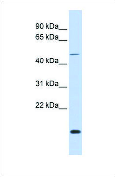 Anti-FOXN3 antibody produced in rabbit affinity isolated antibody