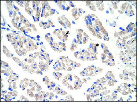 Anti-ACO1 antibody produced in rabbit affinity isolated antibody