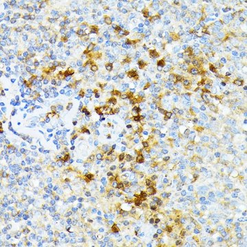 Anti-SPTA1 antibody produced in rabbit