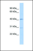 Anti-SQSTM1 antibody produced in rabbit affinity isolated antibody