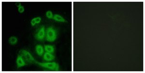 Anti-FXR2 antibody produced in rabbit affinity isolated antibody