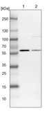 Anti-UMPS antibody produced in rabbit Prestige Antibodies® Powered by Atlas Antibodies, affinity isolated antibody, buffered aqueous glycerol solution
